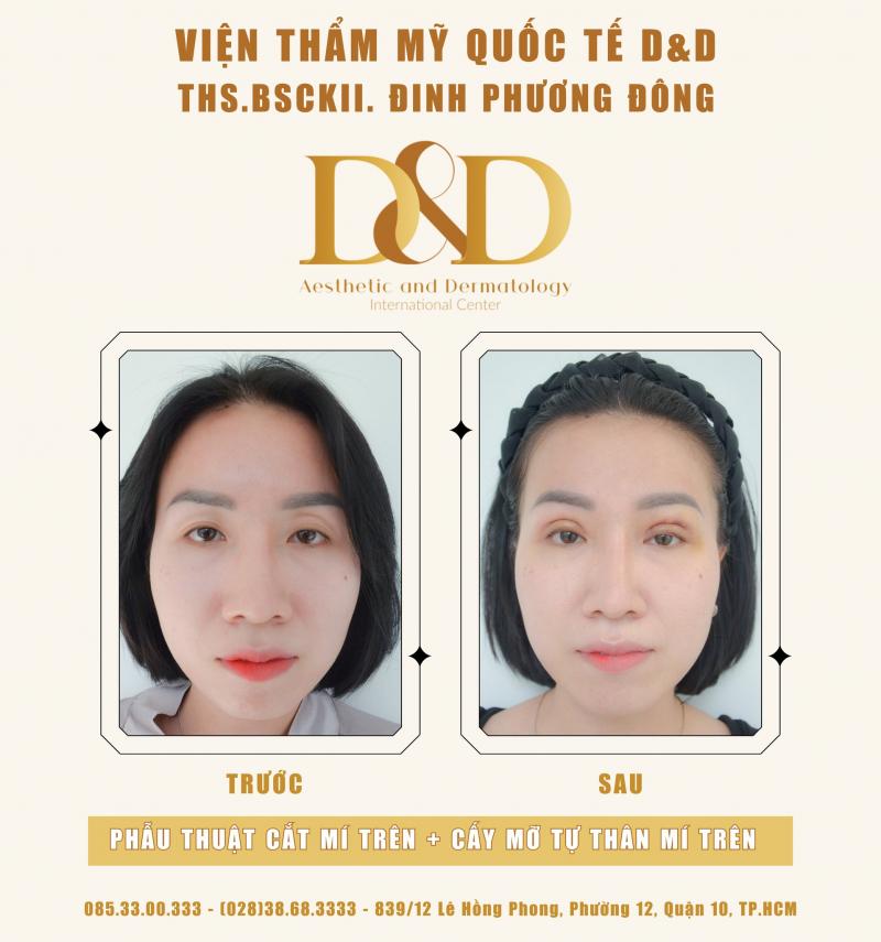 Viện Thẩm Mỹ Quốc Tế D&D