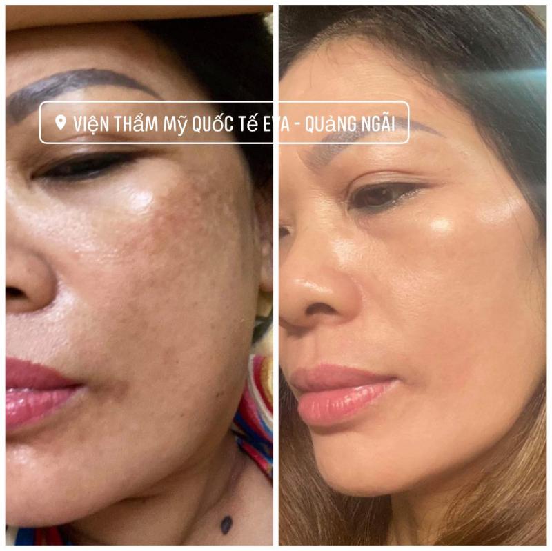 Viện Thẩm Mỹ Quốc Tế EVA