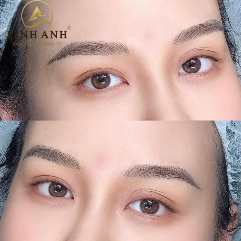 VIỆN THẨM MỸ QUỐC TẾ LINH ANH