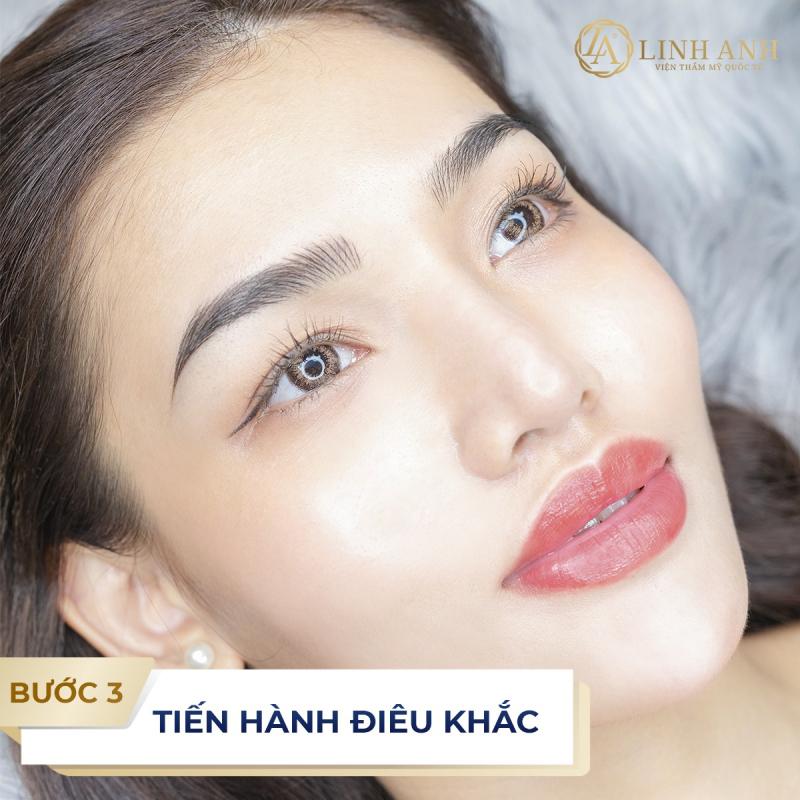 Viện Thẩm Mỹ Quốc Tế Linh Anh