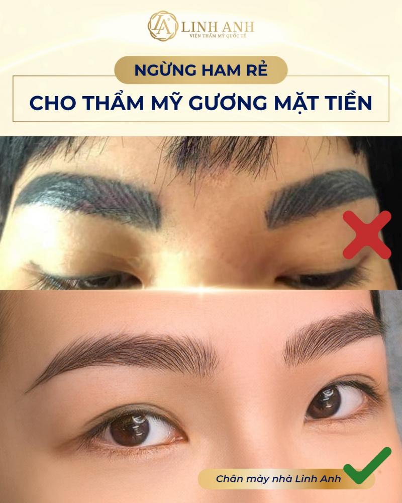 Viện Thẩm Mỹ Quốc Tế Linh Anh