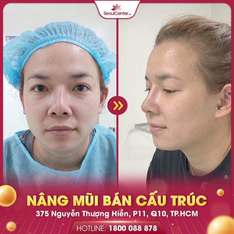 Viện thẩm mỹ Seoul Center