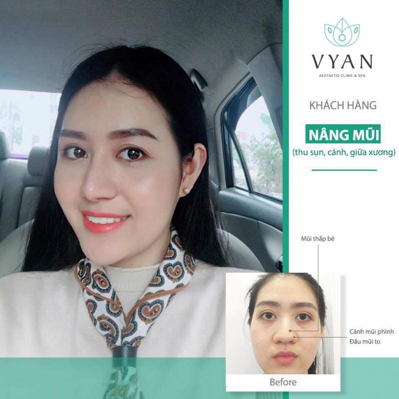 Viện Thẩm Mỹ Vy An